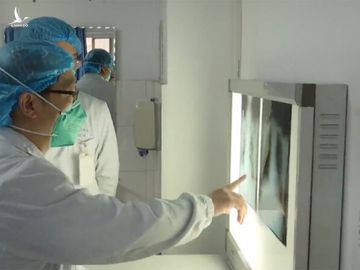Bác sĩ kiểm tra phim X-quang bệnh nhân tại bệnh viện Vũ Hán, tỉnh Hồ Bắc, Trung Quốc hôm 19/1. Ảnh: Xinhua.