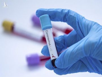 Mỹ sử dụng kit xét nghiệm virus corona cho kết quả sau 45 phút - 1