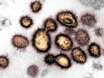 biến chủng sars-cov-2 ở ấn độ đe dọa nỗ lực điều chế vaccine hình 1 bien chung sars-cov-2 o an do de doa no luc dieu che vaccine hinh 1