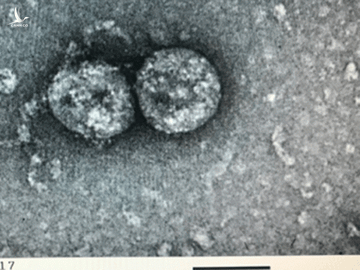 Virus SARS-CoV-2 do các nhà khoa học thuộc Viện Vệ sinh dịch tễ T.Ư nuôi cấy, phân lập từ bệnh phẩm của bệnh nhân ghi nhận đầu vụ dịch Covid-19 /// ẢNH LIÊN CHÂU