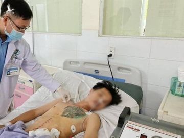 Ngoạn mục cứu sống người đàn ông Bình Dương ăn gần 1kg dị vật kim loại 2