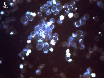 Đức cảnh báo loại virus đang lây lan &quot;nguy hiểm hơn cả Covid&quot; - Ảnh 1.