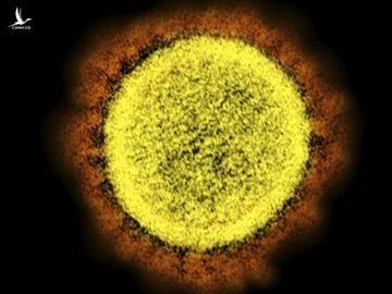 Virus corona mới nhìn từ kính hiển vi điện tử. Ảnh: Kyodo.
