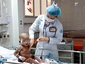 TPHCM: Cha mẹ xông hơi trị Covid-19 cho con, nhiều trẻ bỏng nặng thương tâm - 2