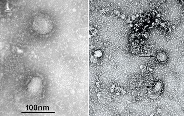 Trung Quốc công bố “chân dung” virus corona: Sự nguy hiểm chết người đằng sau tử thần nhỏ hơn cả bụi siêu mịn