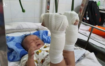 Con trai 4 tháng tuổi nghi bị cha ruột ‘chơi đá’ đánh đến xuất huyết não, gãy chân