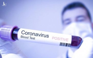Bệnh nhân thứ 33 bị nhiễm Covid-19 đã đi đến nhiều nơi có đông người