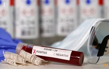Đã tìm ra phương thức xét nghiệm COVID-9 siêu nhanh