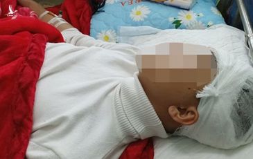 Thanh Hoá: Bắt giam nam sinh đánh bạn vỡ sọ não