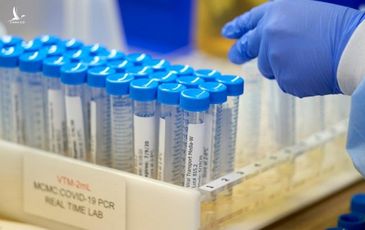 Biến thể COVID mới tại Pháp có thể ‘qua mặt’ xét nghiệm PCR