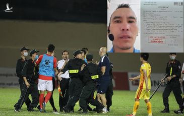 Cầu thủ TPHCM tấn công làm gãy răng trọng tài V-League