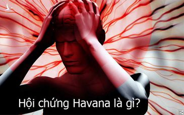 Hội chứng Havana – bí ẩn chưa lời đáp khiến CIA phải vào cuộc