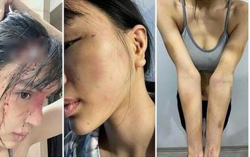 Điều tra vụ ‘siêu mẫu’ Khả Trang tố bị chồng chưa cưới hành hung, giam lỏng