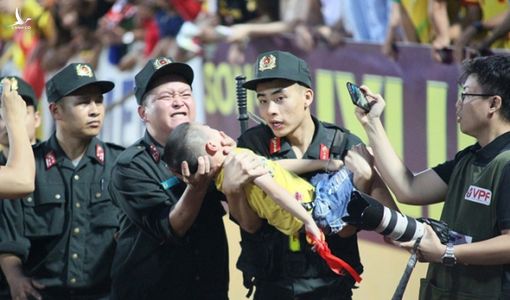 Cảnh sát cơ động cho bé trai cắn tay để tránh bị nuốt lưỡi