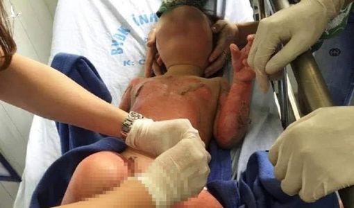 Sở Giáo dục Hà Nam nói về vụ đốt cồn dạy trẻ PCCC