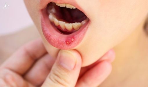 Nhiễm độc thủy ngân gây hại cho sức khỏe như thế nào?