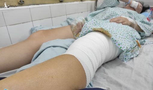 Nữ cổ động viên kể khoảnh khắc bị pháo sáng ném vào chân ở Hàng Đẫy