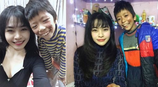 Cảm phục cô gái trẻ nhận nuôi bé gái lở loét