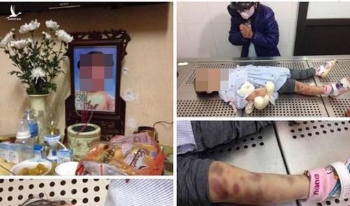 Vụ bé 3 tuổi bị bạo hành tử vong: Có dấu hiệu giết người