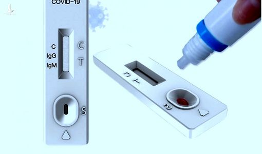 Hàng loạt các quốc gia nhận trái đắng từ bộ test nhanh kháng thể SARS-CoV-2