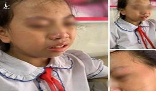 Một cái tát bị đình chỉ 3 tháng dạy học