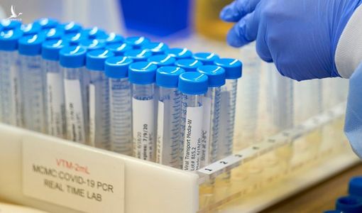 Cảnh báo biến thể mới SARS-CoV-2 có thể gây âm tính giả