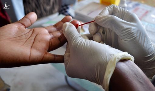 Vì sao TP.HCM khó kiểm soát người nhiễm HIV?