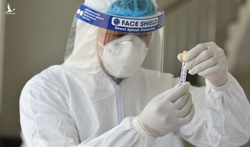 Kết quả xét nghiệm Covid-19 của 96 người tiếp xúc với BN 2580 ở TP HCM