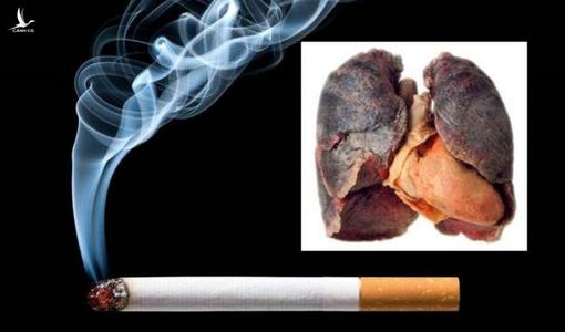 Người hút thuốc lá nếu mắc Covid-19 dễ tử vong hơn người không hút