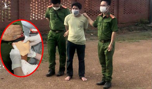 Bắt được hung thủ chém gần đứt lìa cánh tay thượng úy công an Bình Thuận