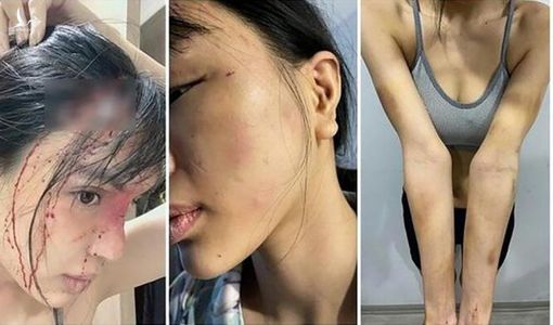 Điều tra vụ ‘siêu mẫu’ Khả Trang tố bị chồng chưa cưới hành hung, giam lỏng