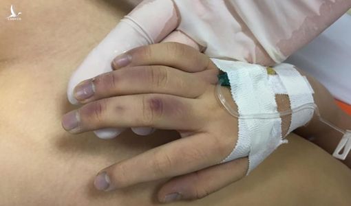 Vụ bé gái 6 tuổi ở Hà Nội tử vong: Bị bố đánh bằng thanh tre, cán chổi không thương tiếc