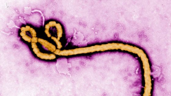 Nhật Bản vừa nhập khẩu virus Ebola và 4 mầm bệnh sốt xuất huyết nguy hiểm nhất