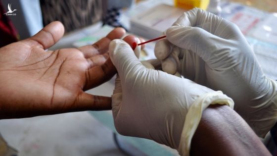 Vì sao TP.HCM khó kiểm soát người nhiễm HIV?