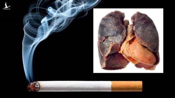 Người hút thuốc lá nếu mắc Covid-19 dễ tử vong hơn người không hút