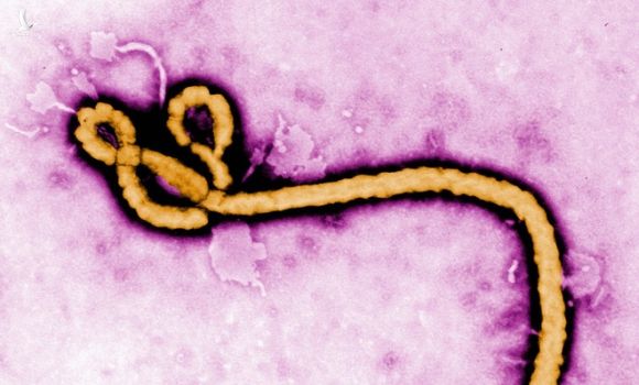 Nhật Bản vừa nhập khẩu virus Ebola và 4 mầm bệnh sốt xuất huyết nguy hiểm nhất